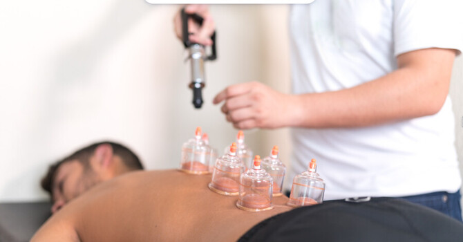 Cupping