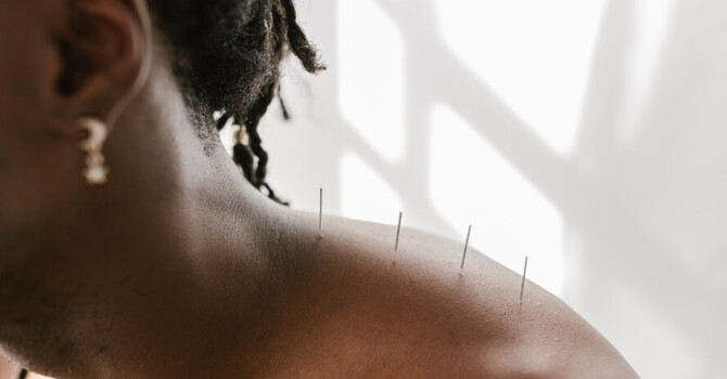 Acupuncture
